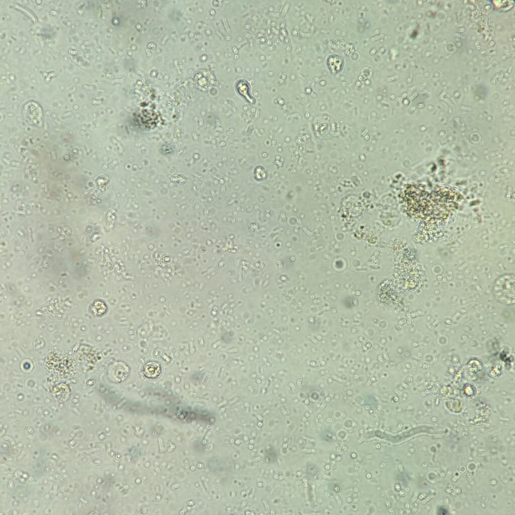 Urine Microscopic with 5-10 white blood cells and 4+ bacteria