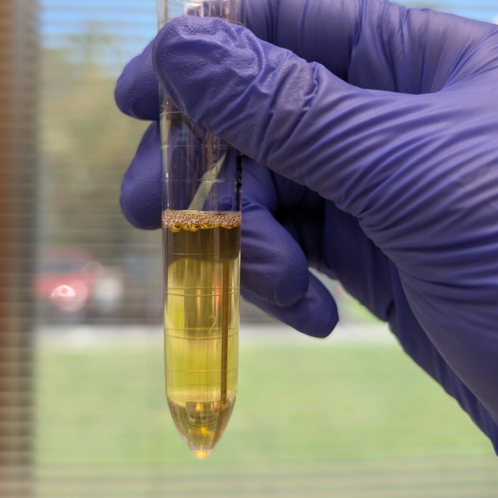 Unspun clear yellow urine