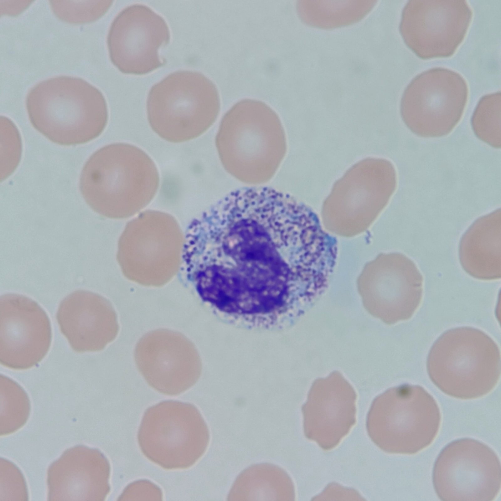 Abnormal Diff Practice-919613