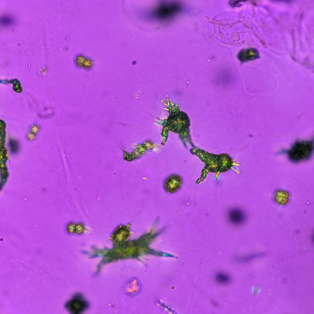 Ammonium Biurate Crystals in urine, polarized