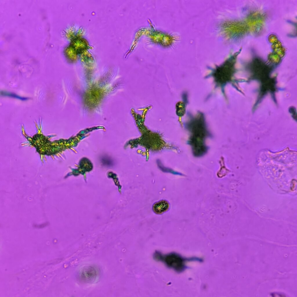 Ammonium Biurate Crystals in urine, polarized