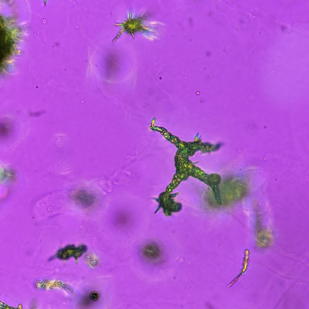 Ammonium Biurate Crystals in urine, polarized