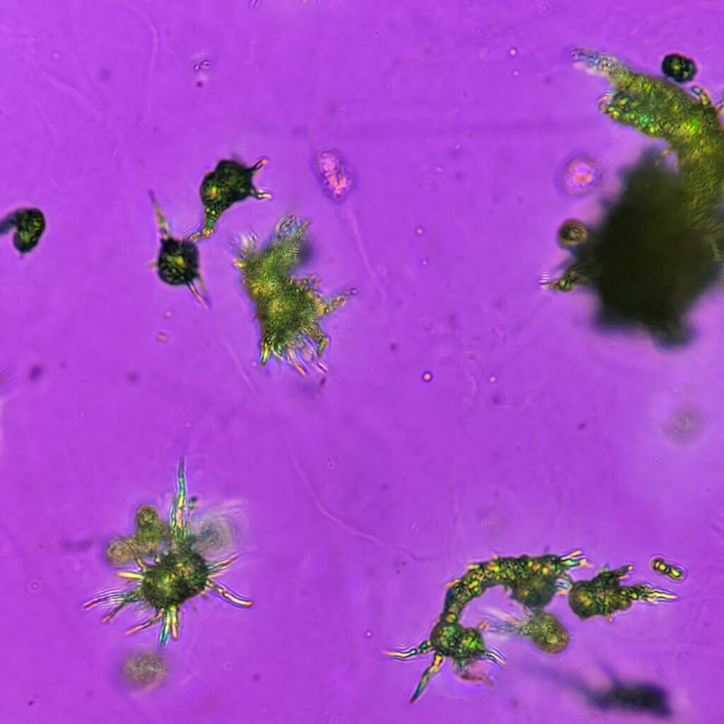 Ammonium Biurate Crystals in urine, polarized