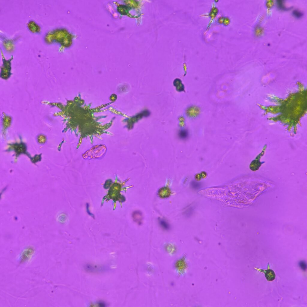 Ammonium Biurate Crystals in urine, polarized