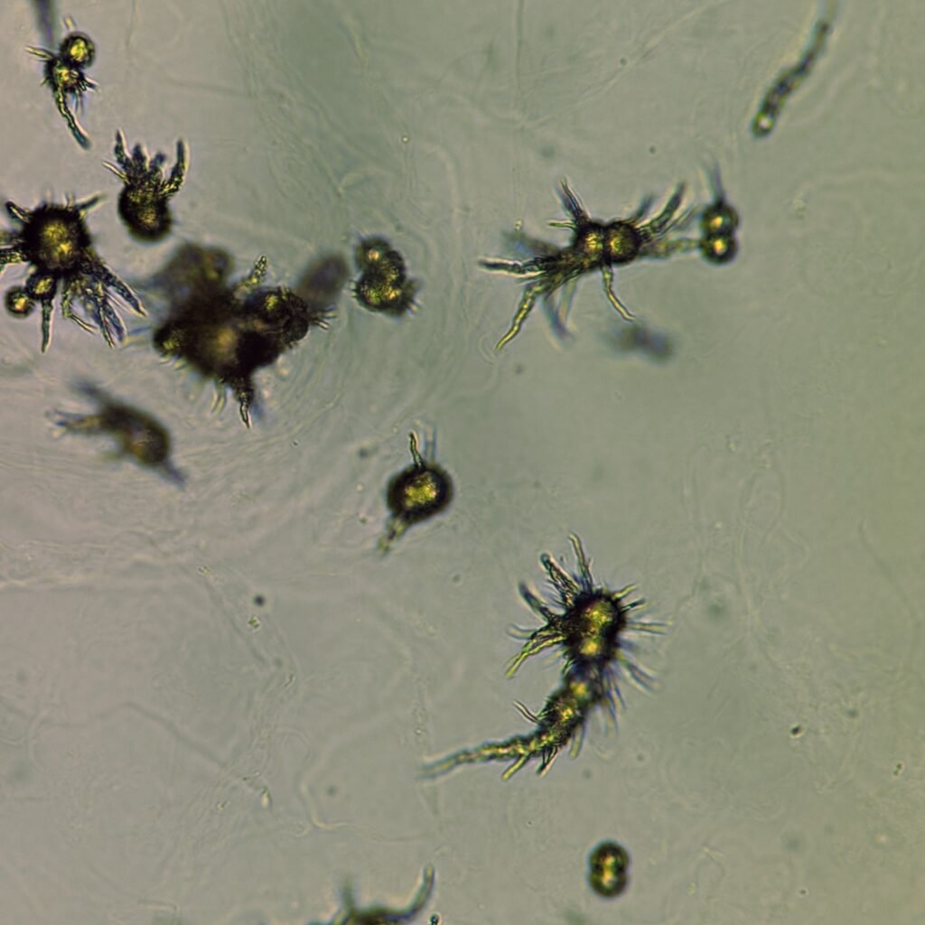 Ammonium Biurate Crystals in urine