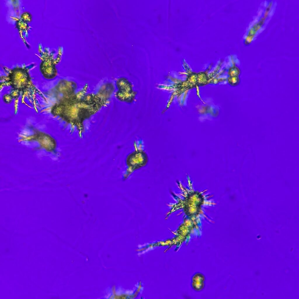 Ammonium Biurate Crystals in urine, polarized