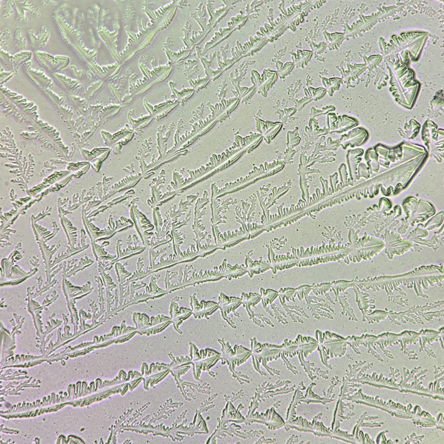 Fern Test Overview: Appearance and Clinical Significance