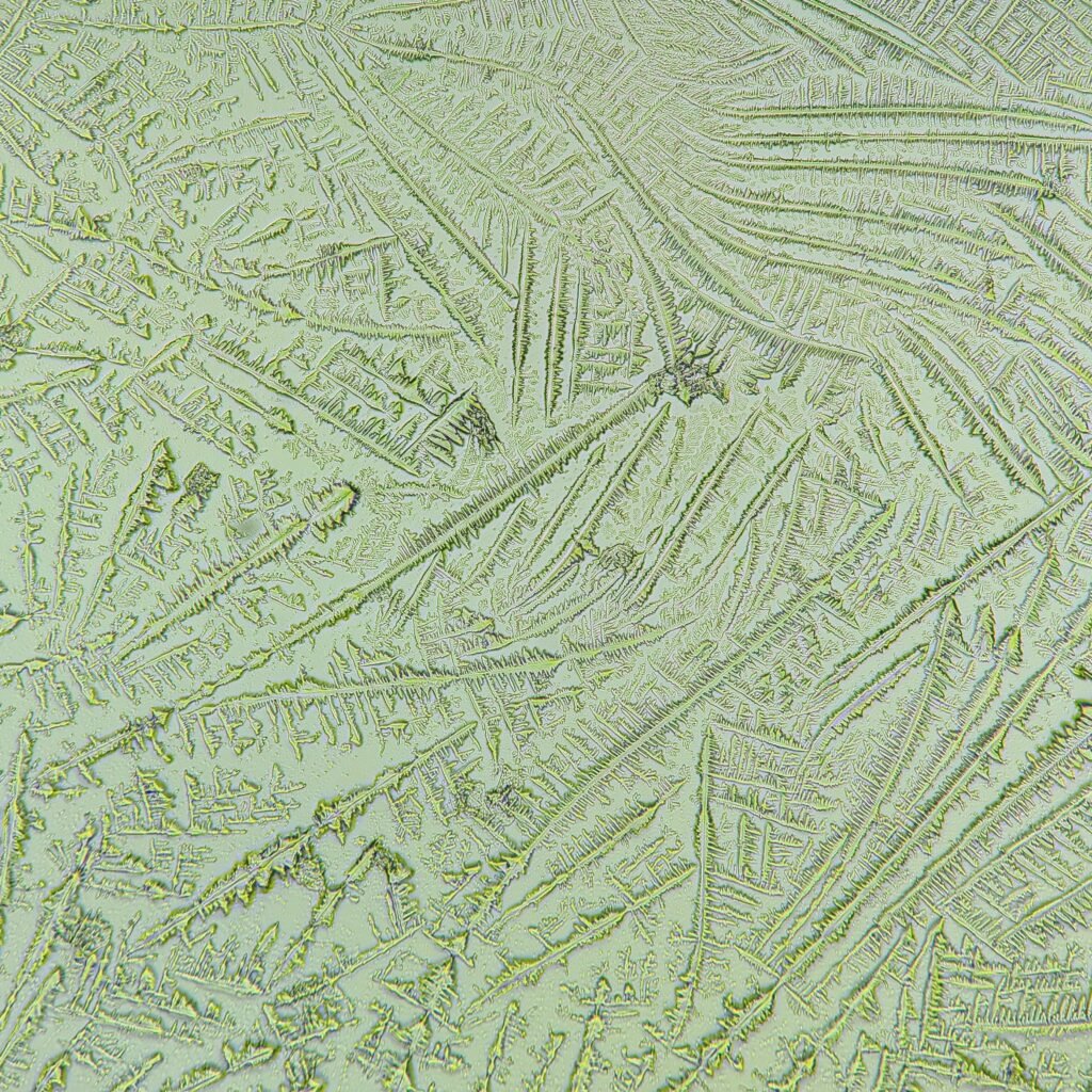 amniotic fluid forming fern-like crystals in fern test
