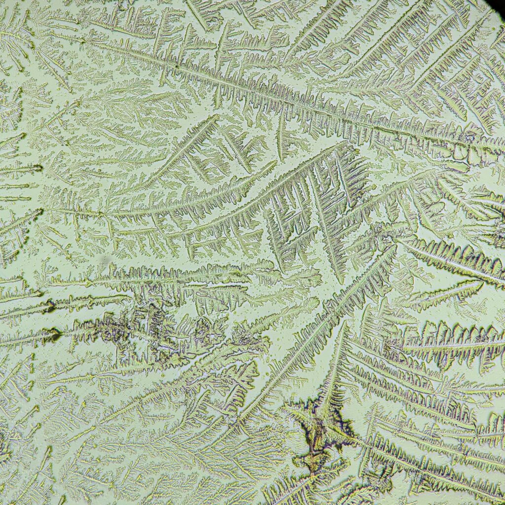 amniotic fluid forming fern-like crystals in fern test