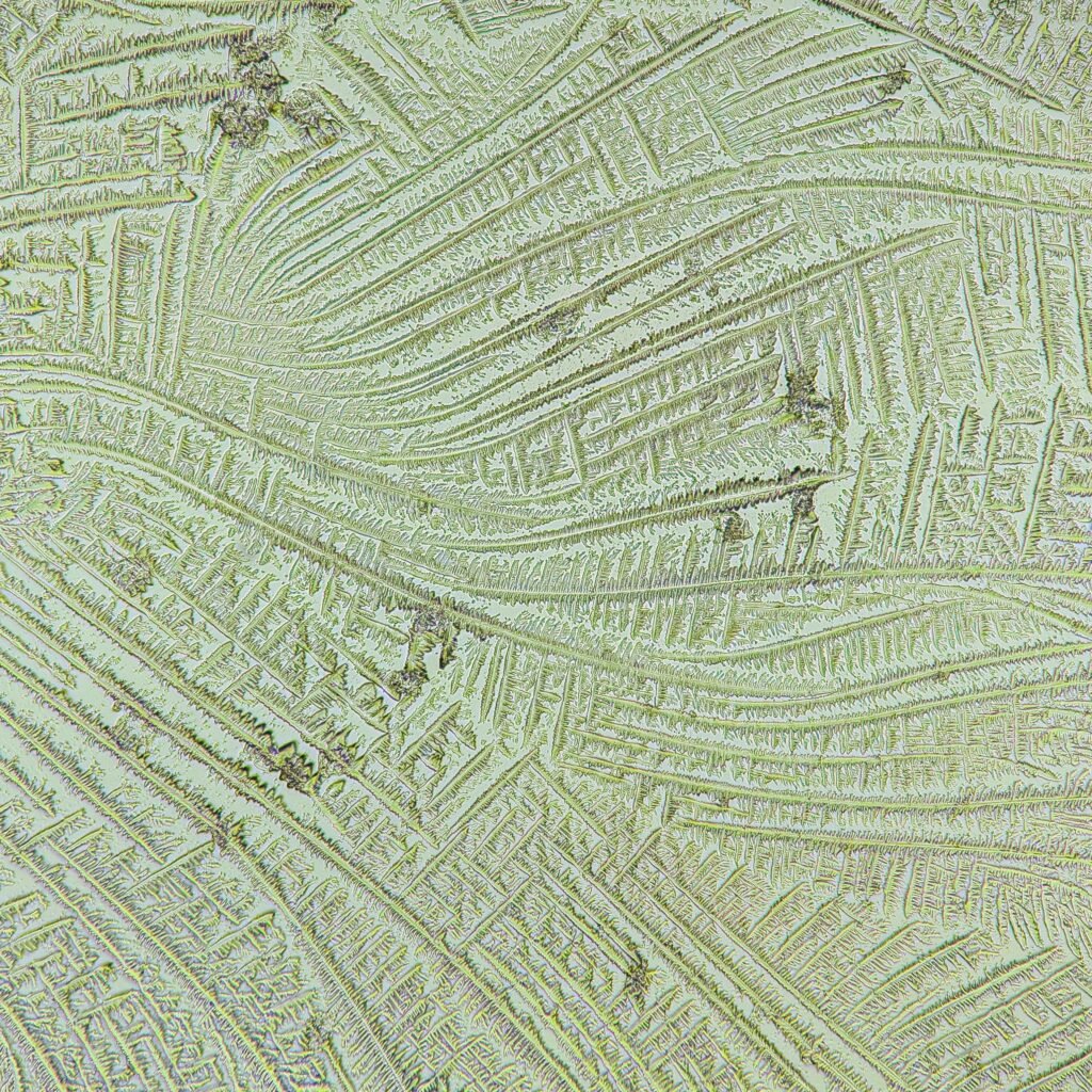 amniotic fluid forming fern-like crystals in fern test
