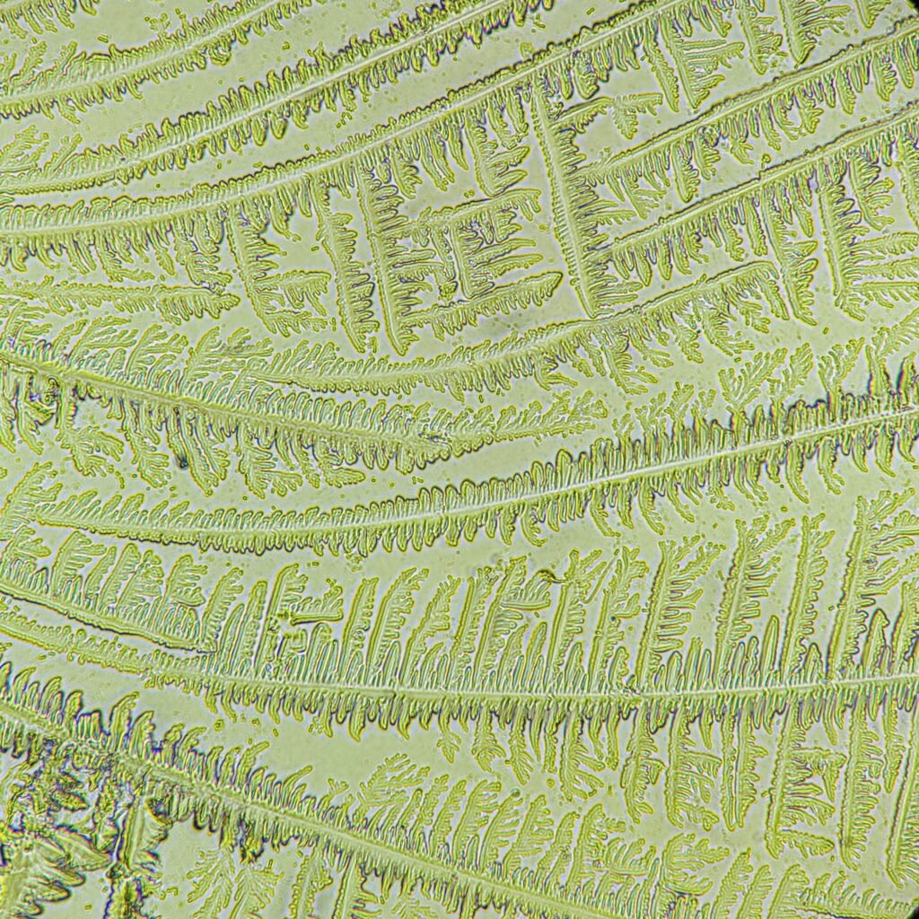 amniotic fluid forming fern-like crystals in fern test