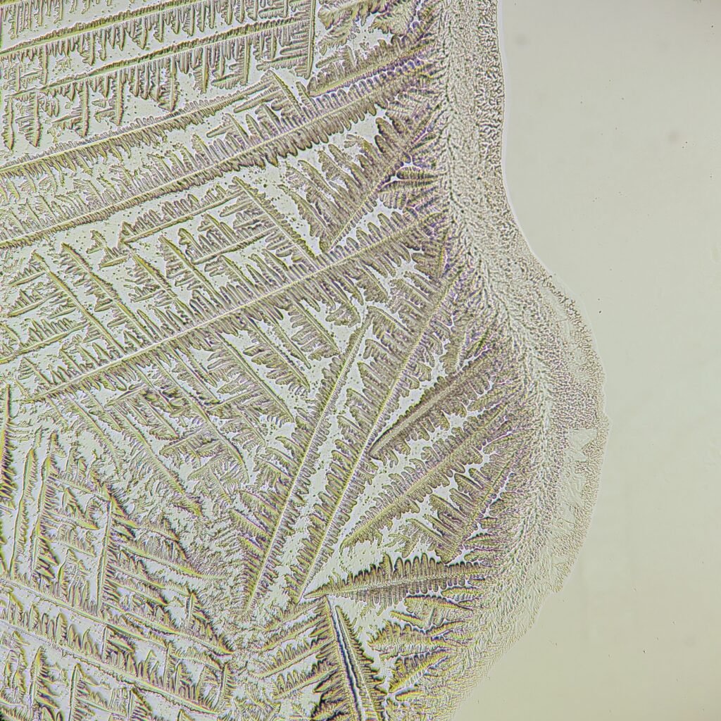 amniotic fluid forming fern-like crystals in fern test