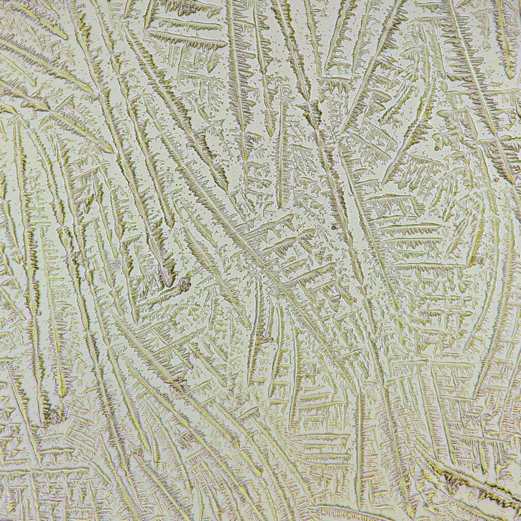 amniotic fluid forming fern-like crystals in fern test