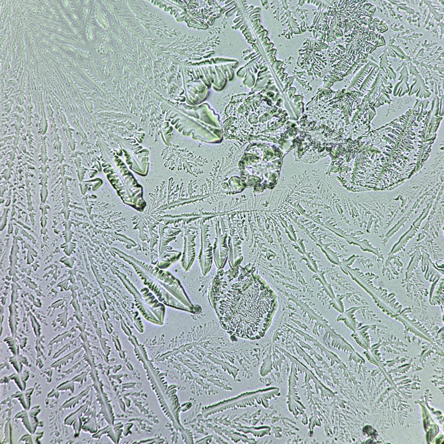 Fern Test Overview: Appearance and Clinical Significance