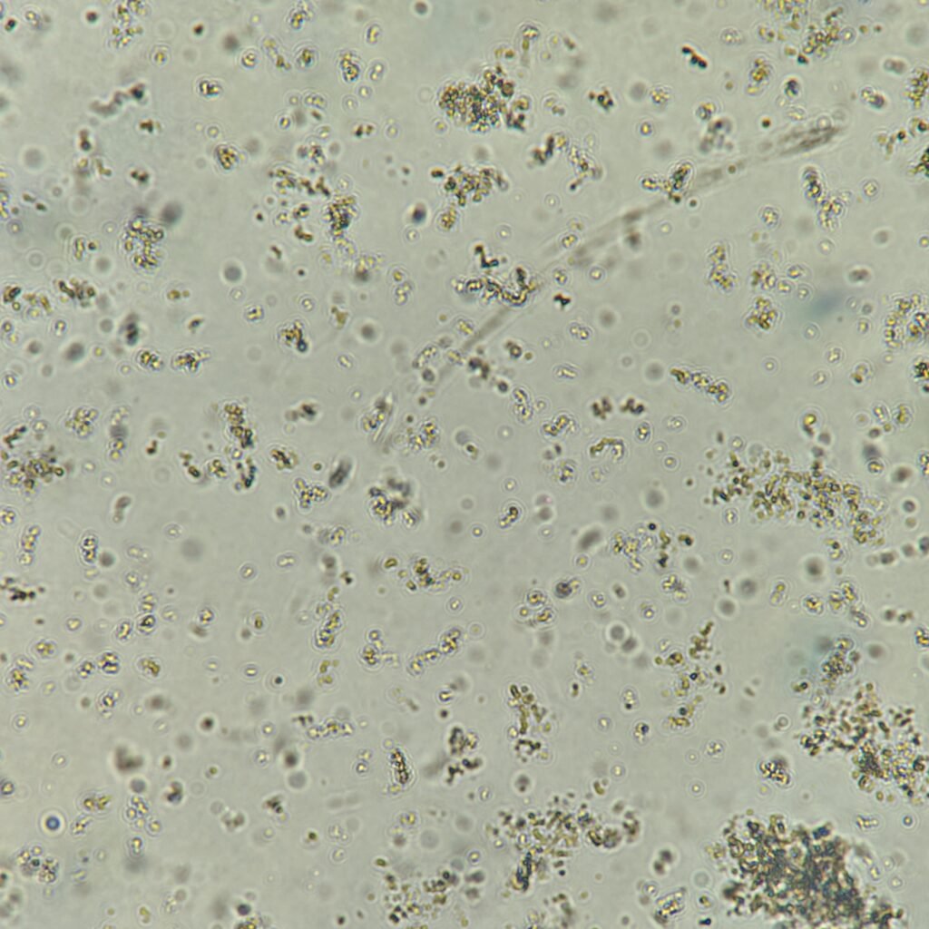 Amorphous phosphate crystals in urine microscopic
