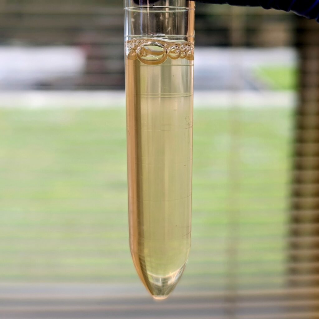amorphous phosphates in urine causing turbidity.