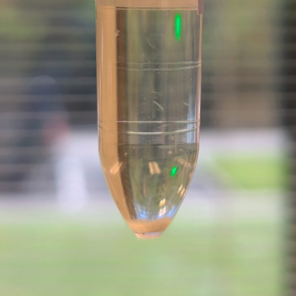 white sediment in urine due to amorphous phosphates