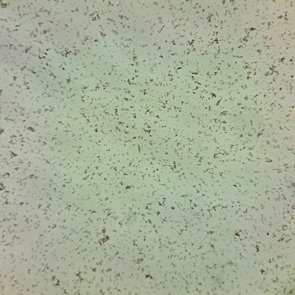 amorphous urates