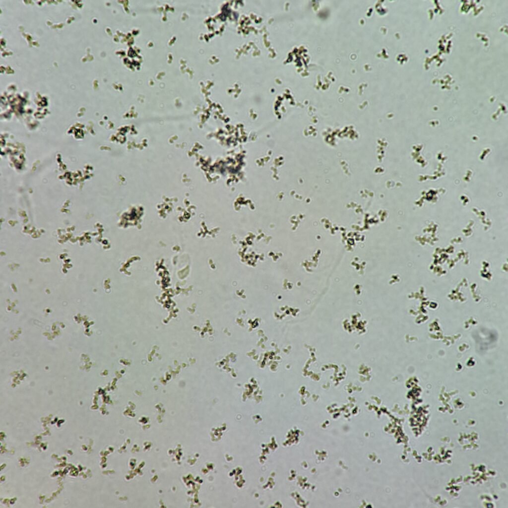 amorphous urates