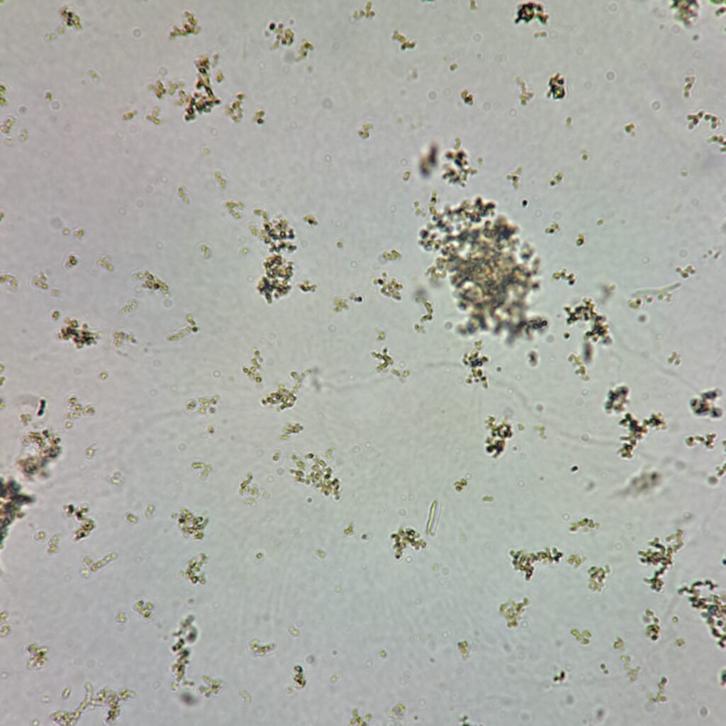 amorphous urates
