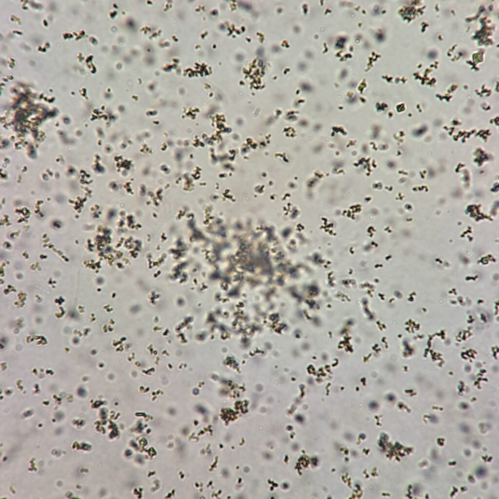 amorphous urates