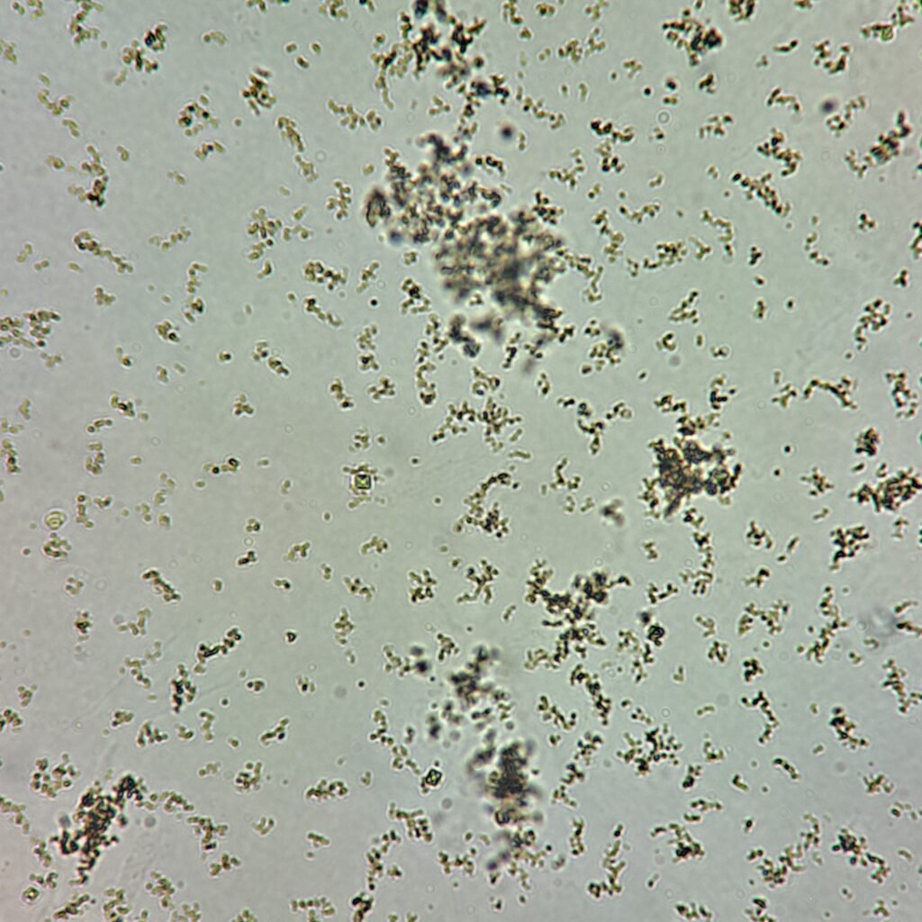 amorphous urates in urine