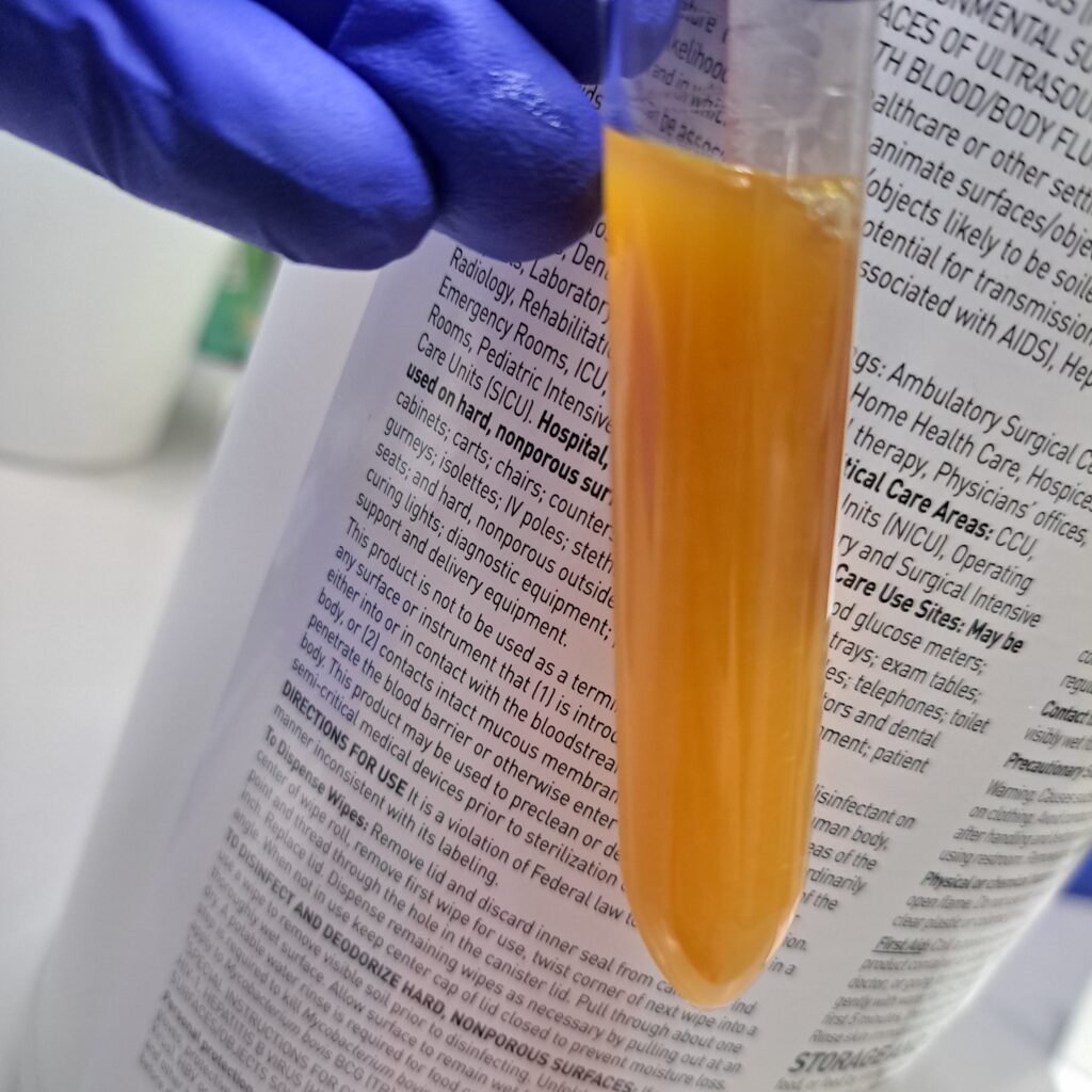 Turbid orange urine