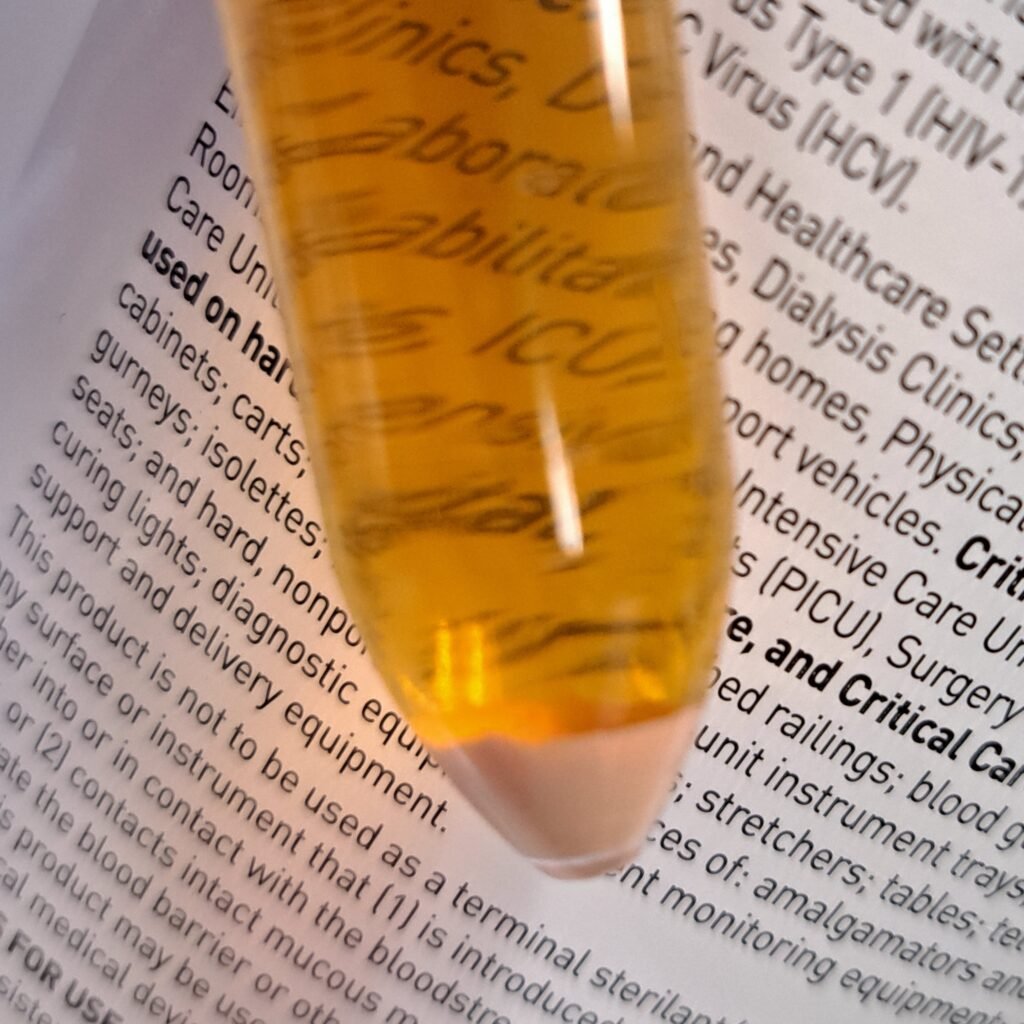 brick dust sediment in urine from amorphous urates