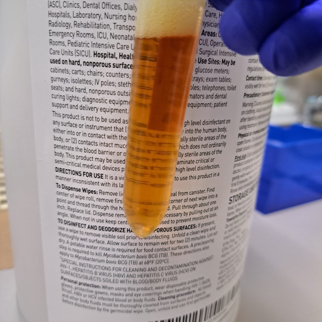 clear orange urine