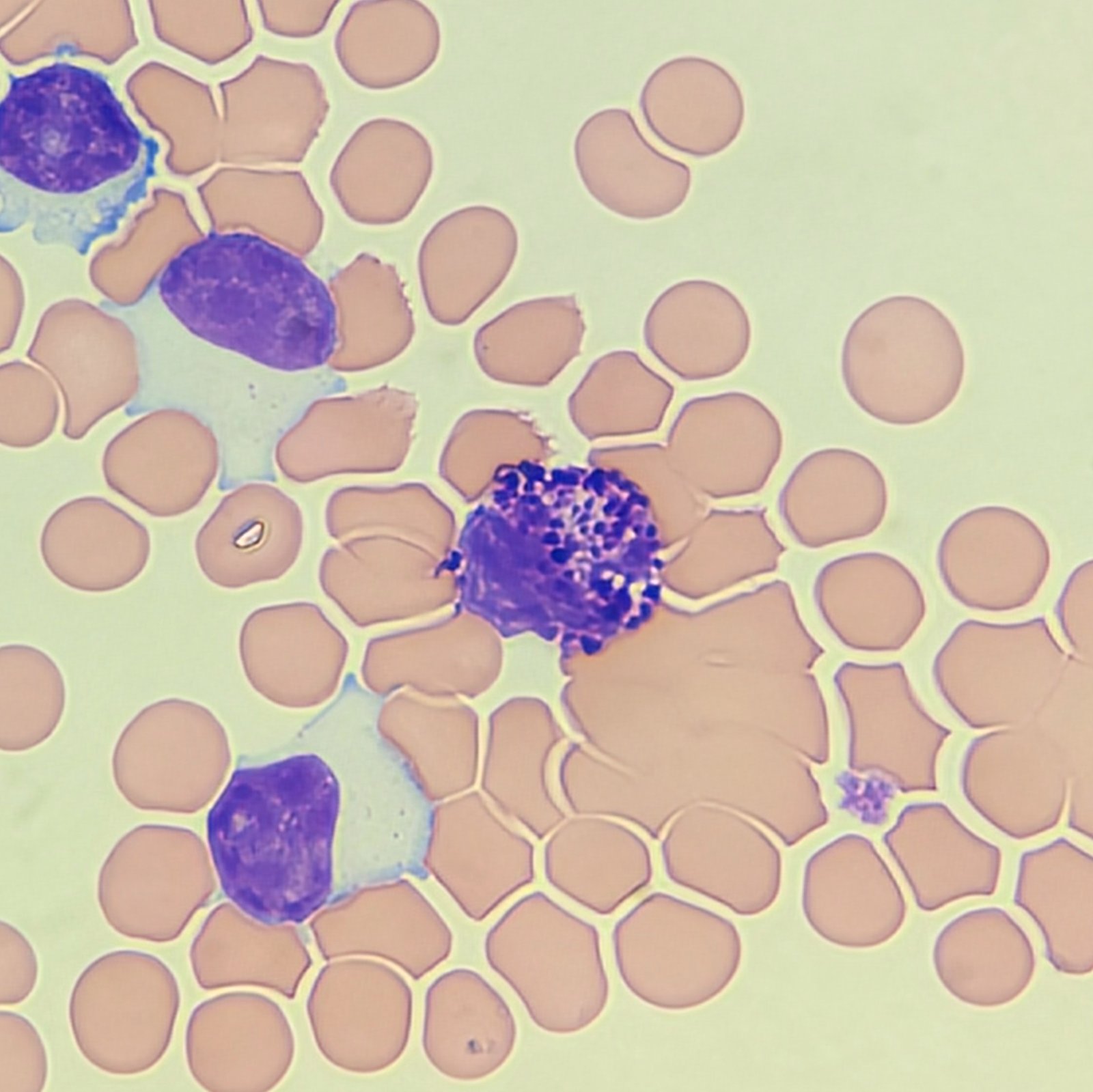 basophil in body fluid