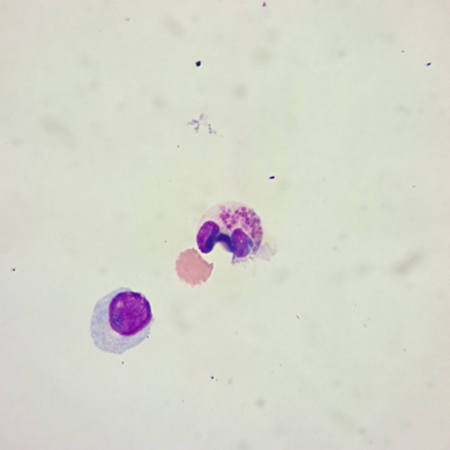 body-fluid-eosinophils-medlabbuddy