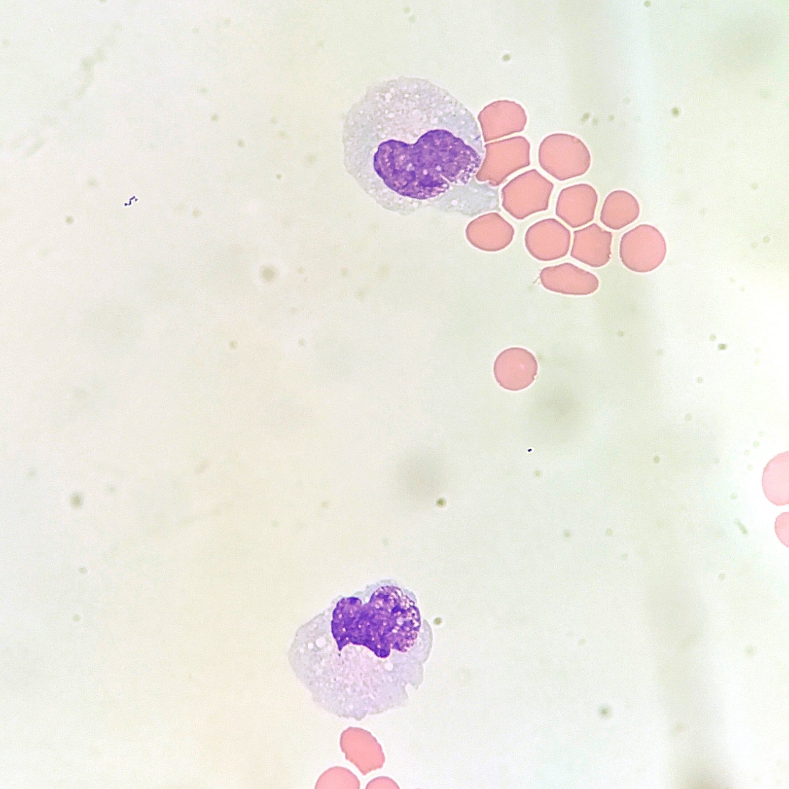 Monocytes in body fluid