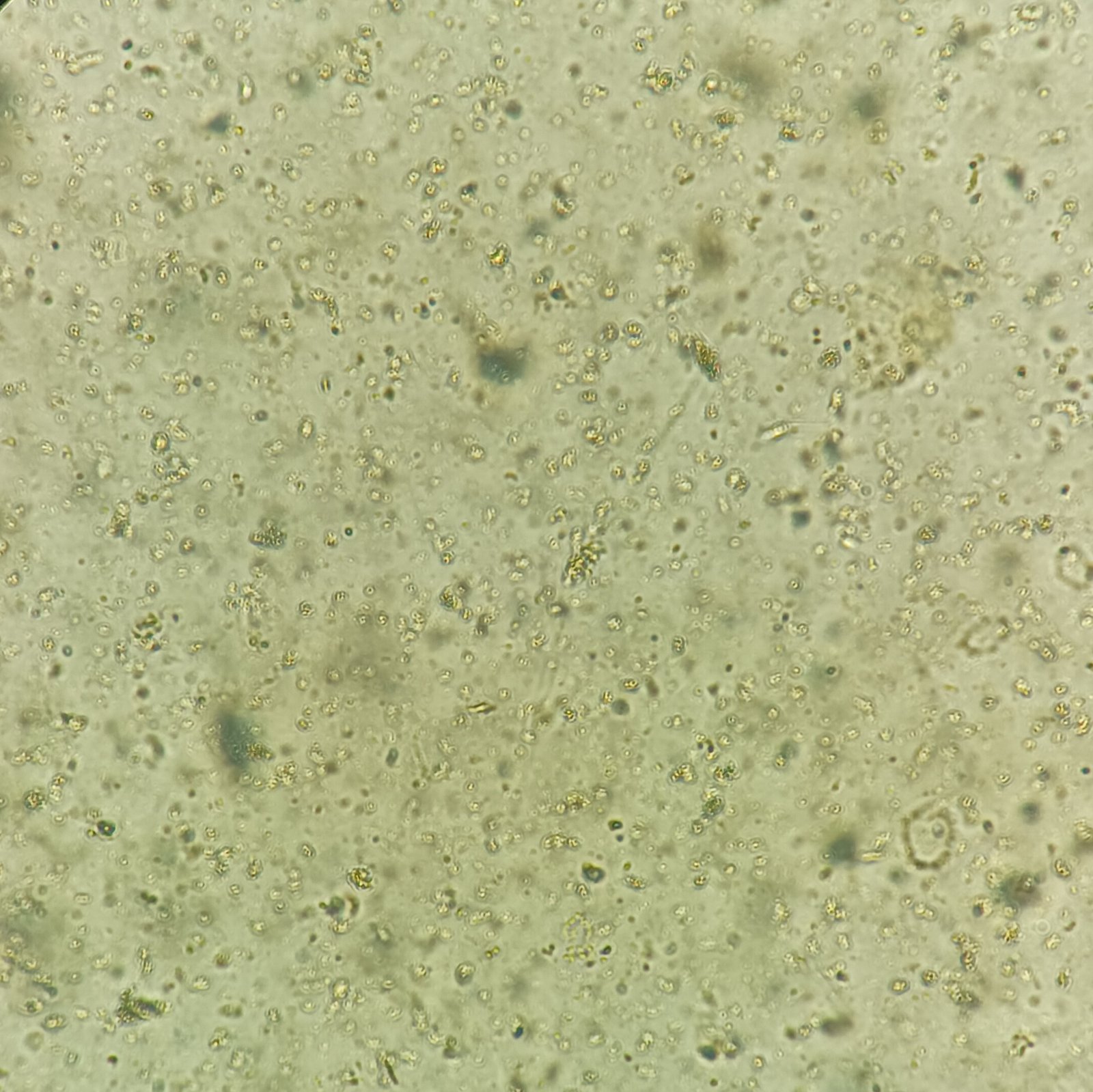Bacteria in urine sediment