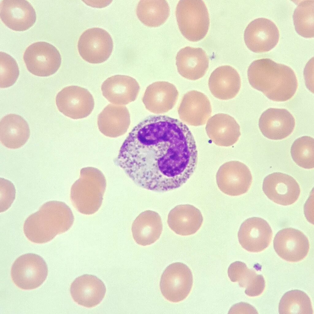 band neutrophil