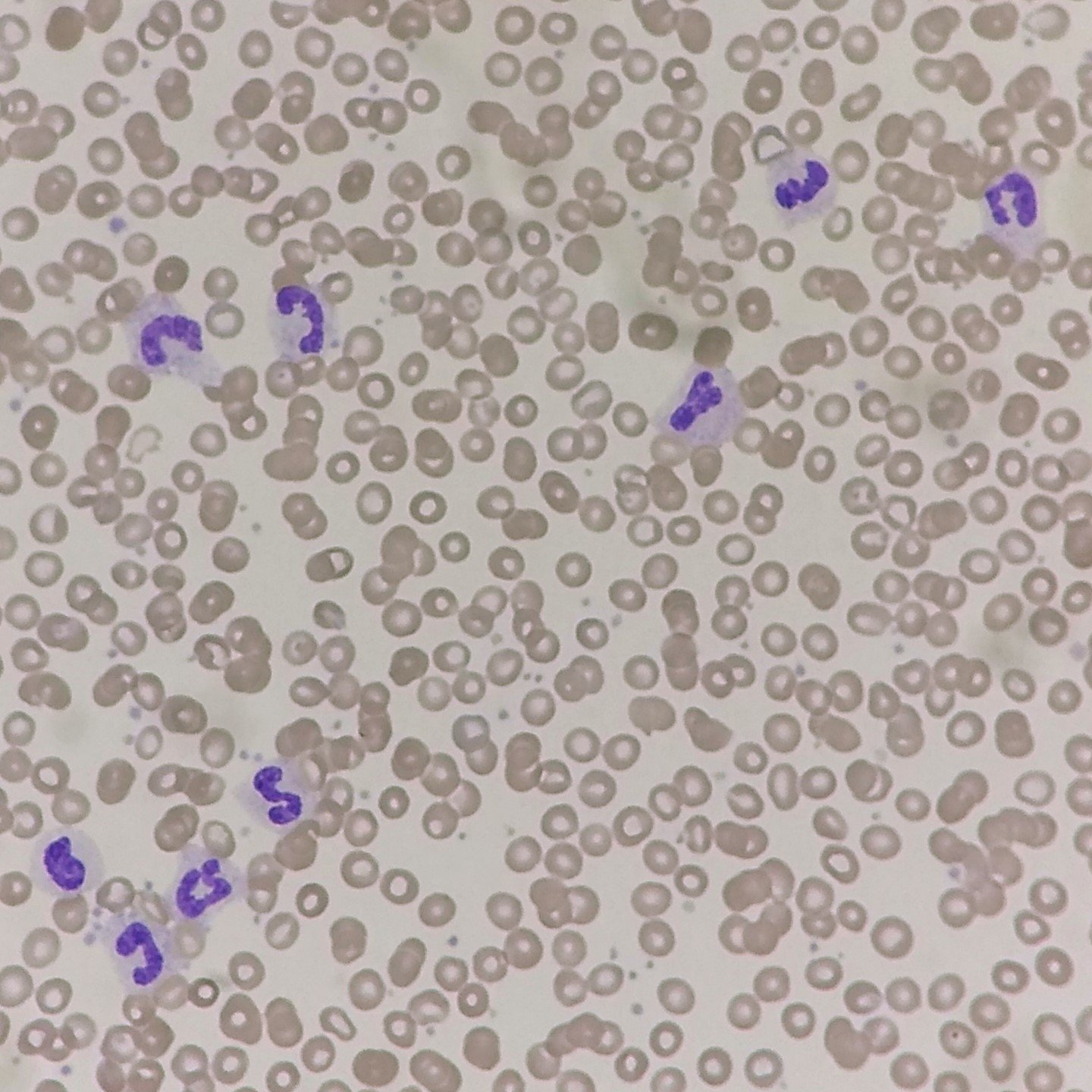 Band Neutrophils: Identification & Differentiation