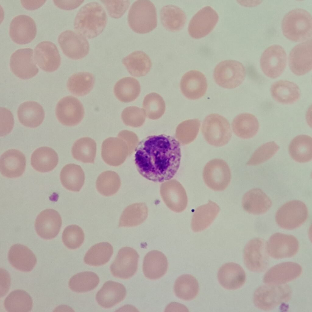 white blood cell: basophil