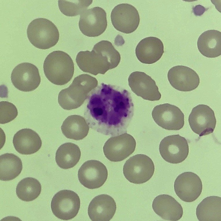 white blood cell: basophil