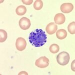 Basophils: Identification & Differentiation
