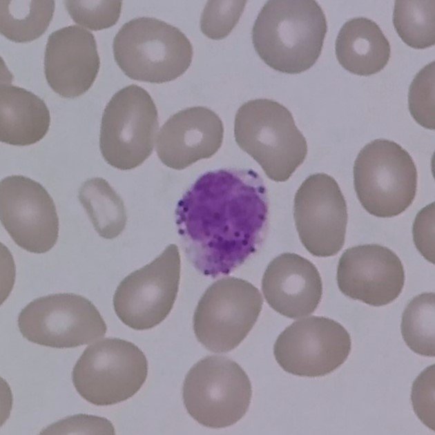 white blood cell: basophil