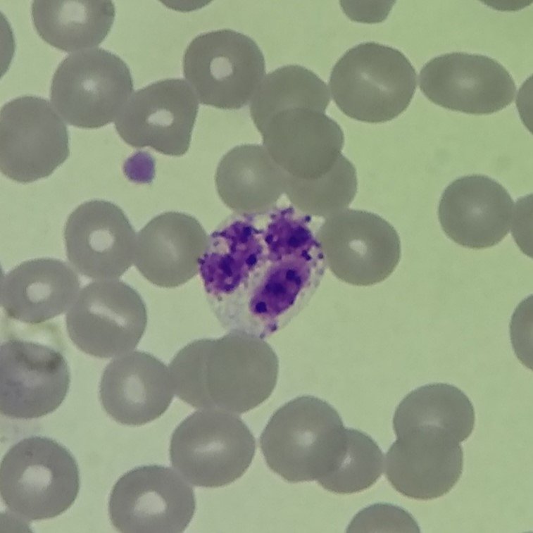 white blood cell: basophil
