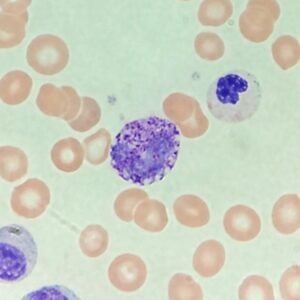 Basophils: Identification & Differentiation