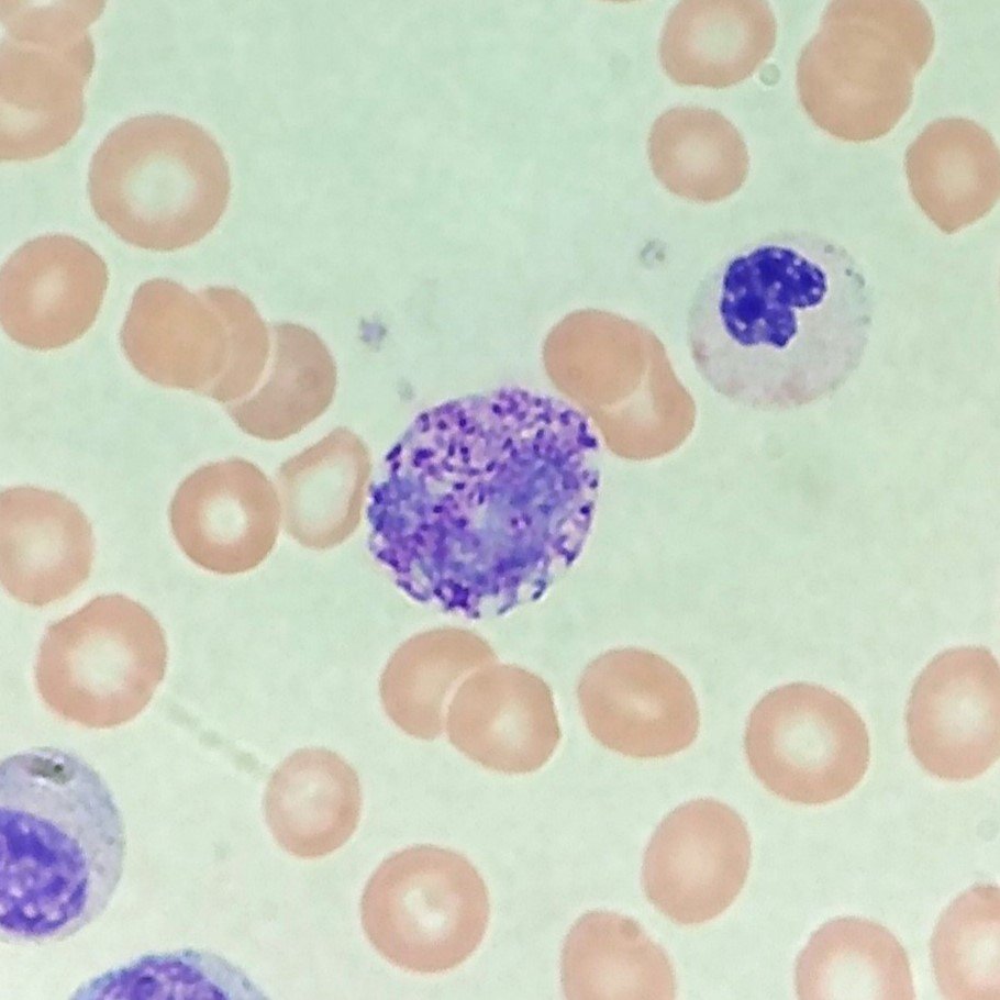 white blood cell: basophil