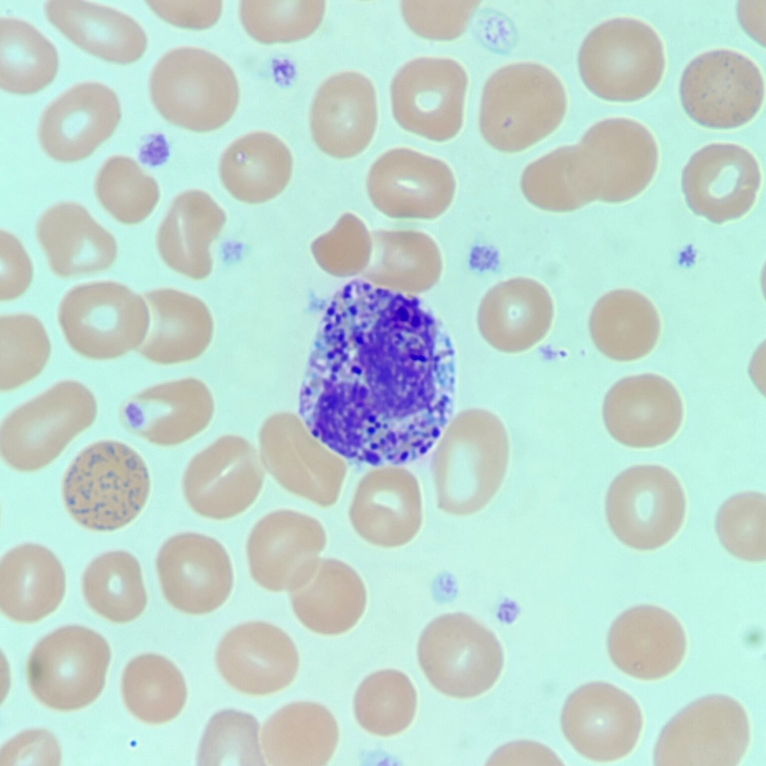 Basophils: Identification & Differentiation