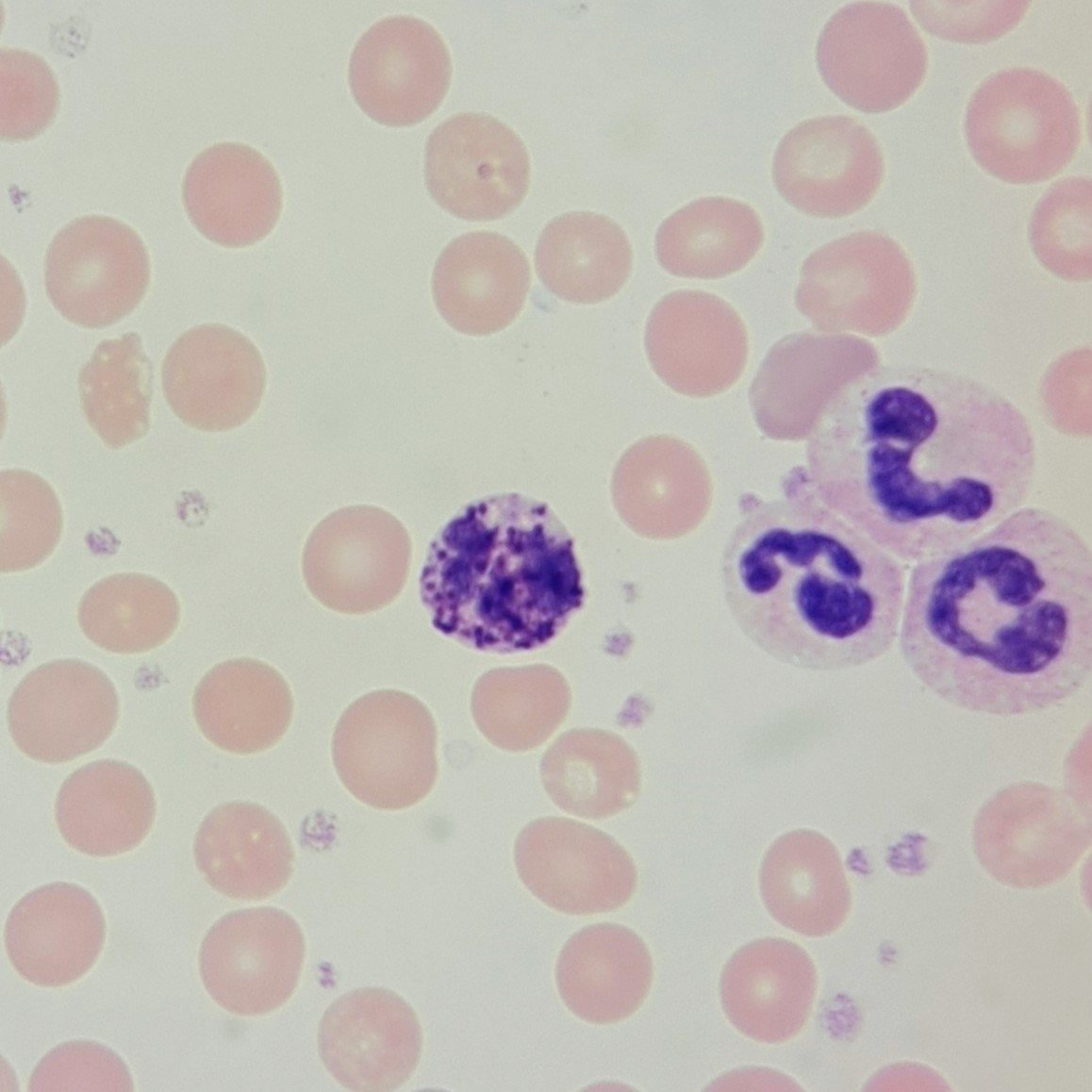 Basophils: Identification & Differentiation