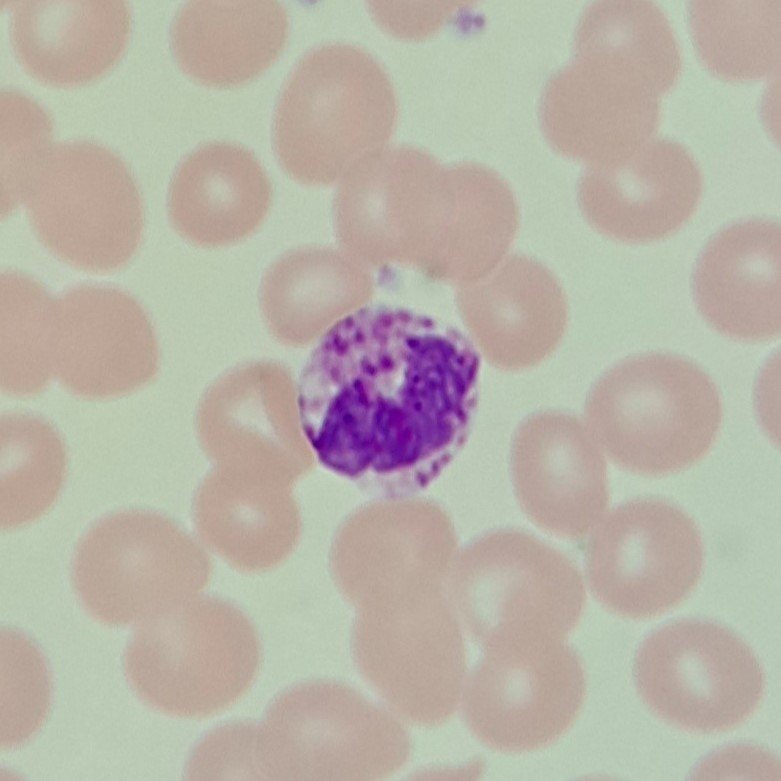white blood cell: basophil