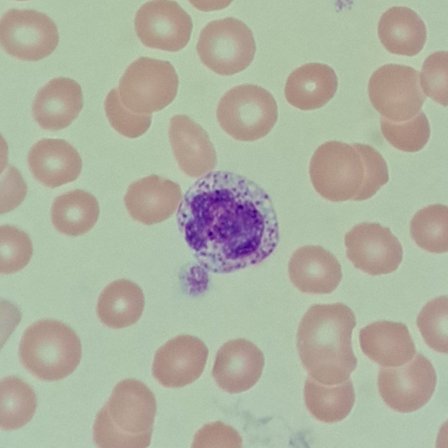 white blood cell: basophil