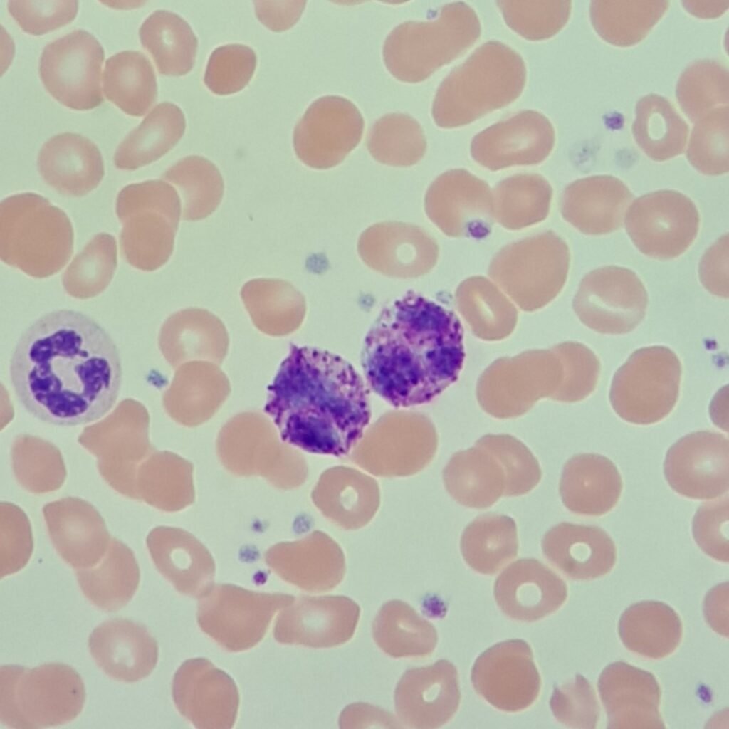 white blood cells: basophils
