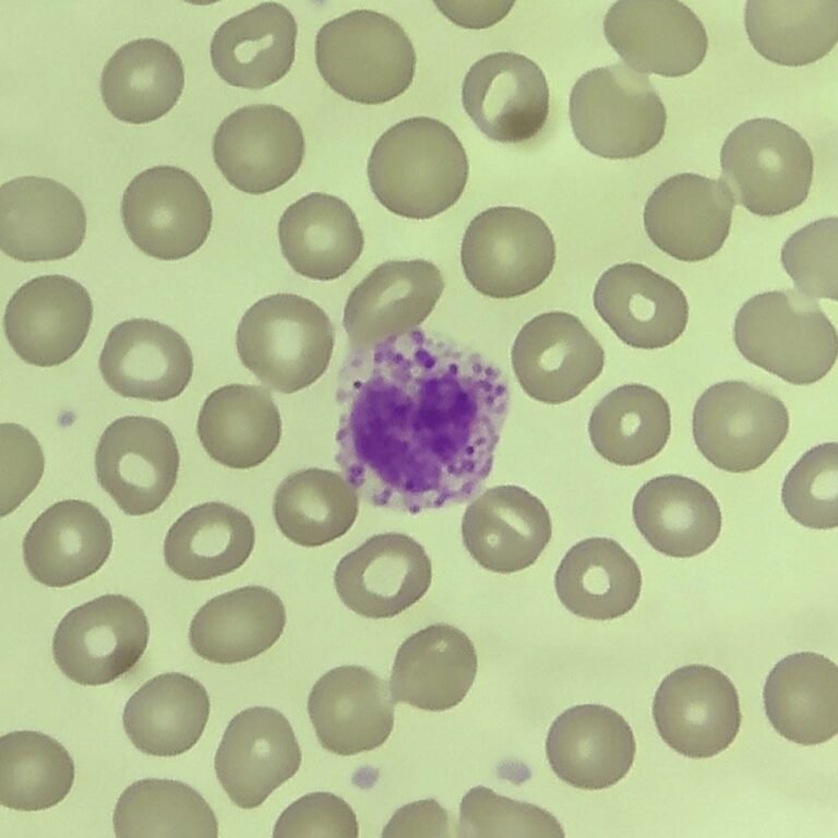 Basophils: Identification & Differentiation
