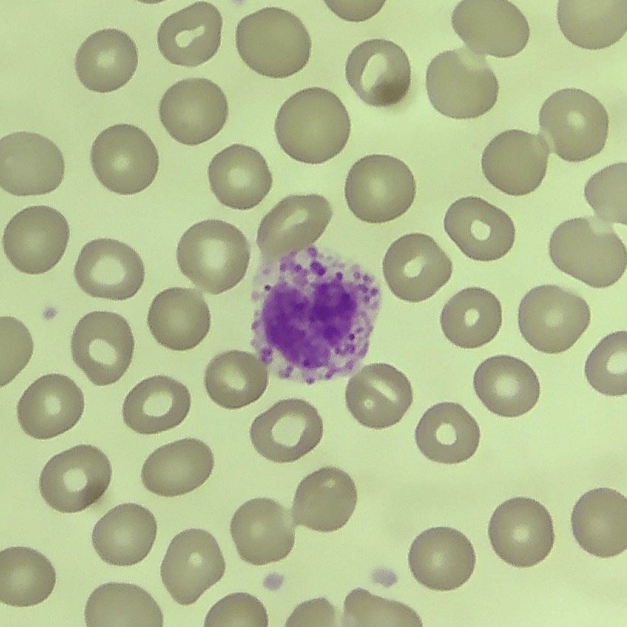 white blood cell: basophil