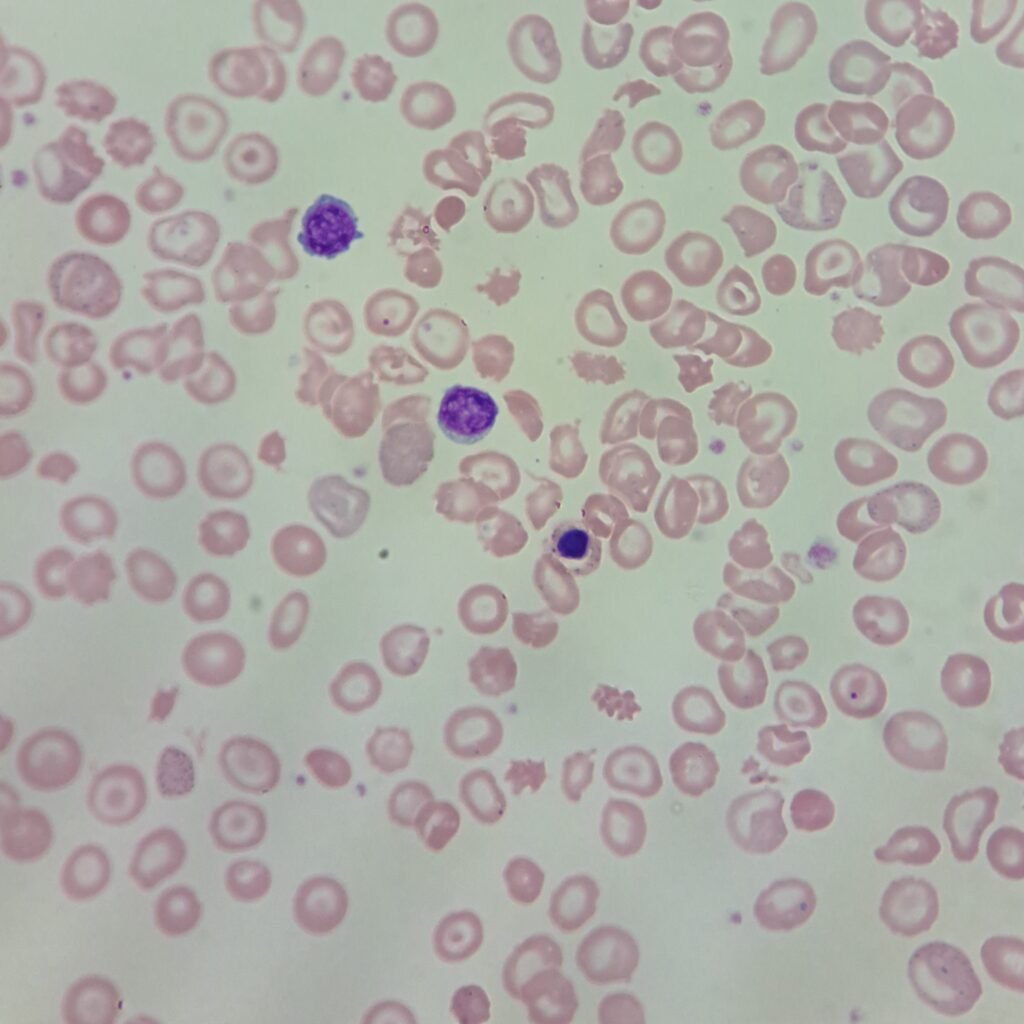 Target Cells, NRBCs, Spherocytes